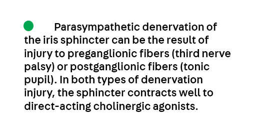Key Point 1 from the article Disorders of the Pupil by Dr. Aki Kawasaki, from the April #Neuroophthalmology issue, which is available to subscribers at hubs.la/Q03kf0tS0.
#Neurology #NeuroTwitter #MedEd