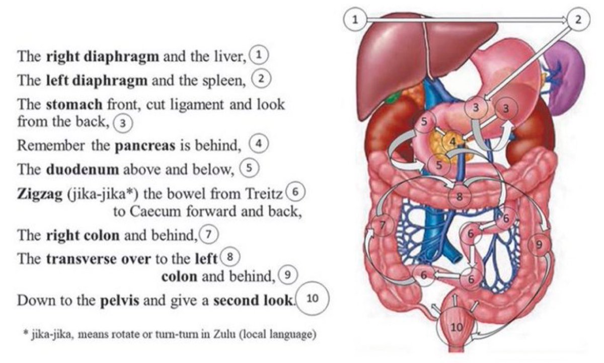 PipeCabreraV's tweet photo. Trauma laparoscopy: how not to miss injuries 🔪👁️💥⤵️! @pferrada1 @TomVargheseJr @SWexner @CiruAndes2 @AmJSurgery https://t.co/ZxiFz1nh9D