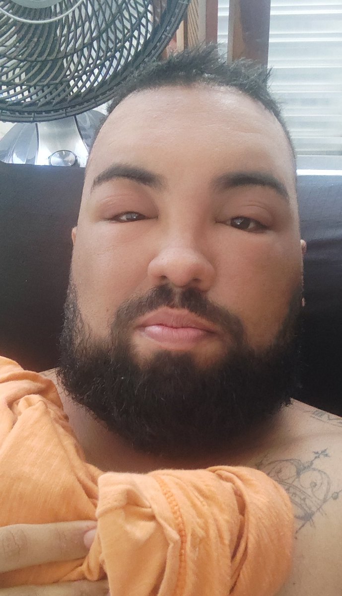 icaroprazeres90's tweet photo. Eu que fui inventar de pintar o cabelo de preto pra tirar o loiro pivete e tive reação alérgica que me fez uma desarmonizaçao facial grátis https://t.co/hNEvsIjHtM