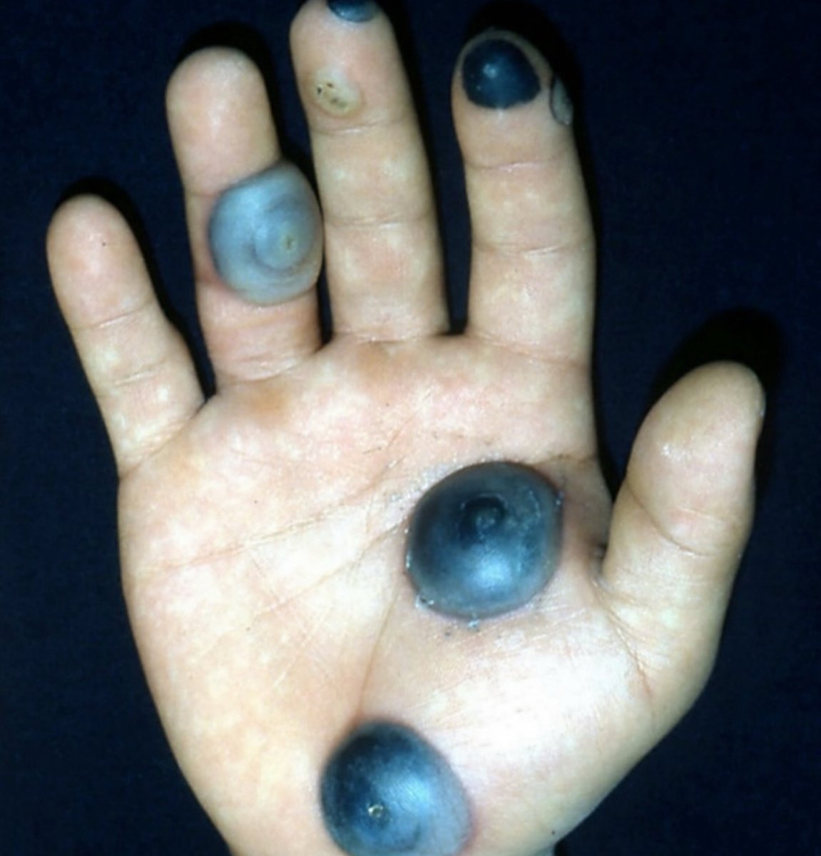 What would you diagnose if you saw this?