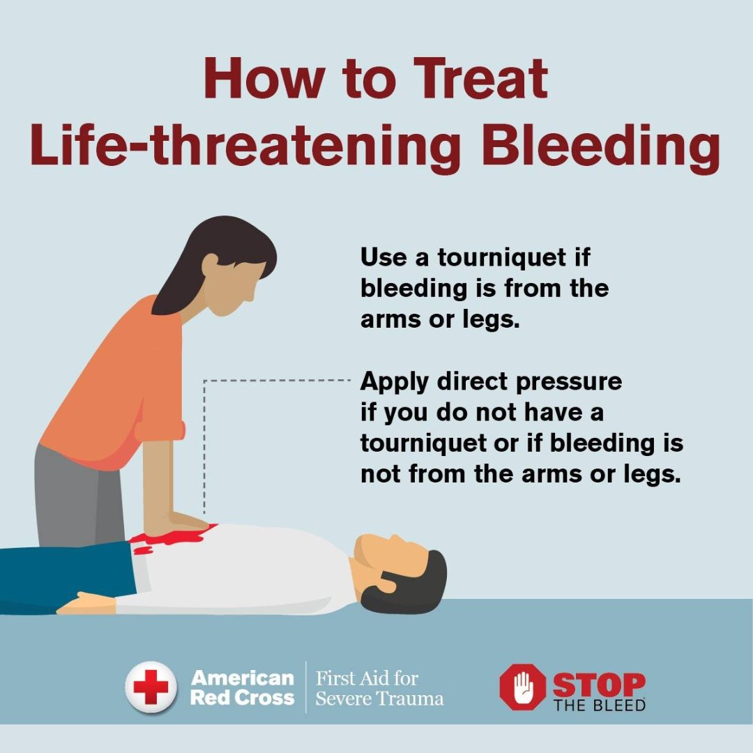❔ 🤔Curious about National Stop the Bleed Day? May 22nd is all about empowering YOU with the knowledge and skills to stop such bleeding until professional help Want to know more? Check this out 👉 rdcrss.org/3SsNF86 Help us #StopTheBleed together! 

#RedCross
