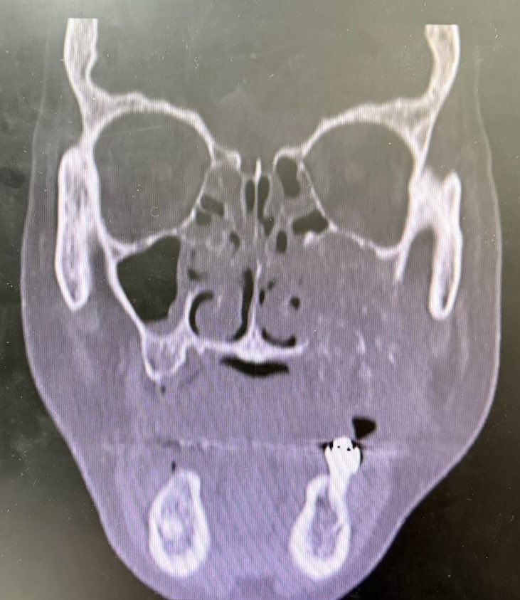 Bruno Sedassari, DMD, PhD tweet media