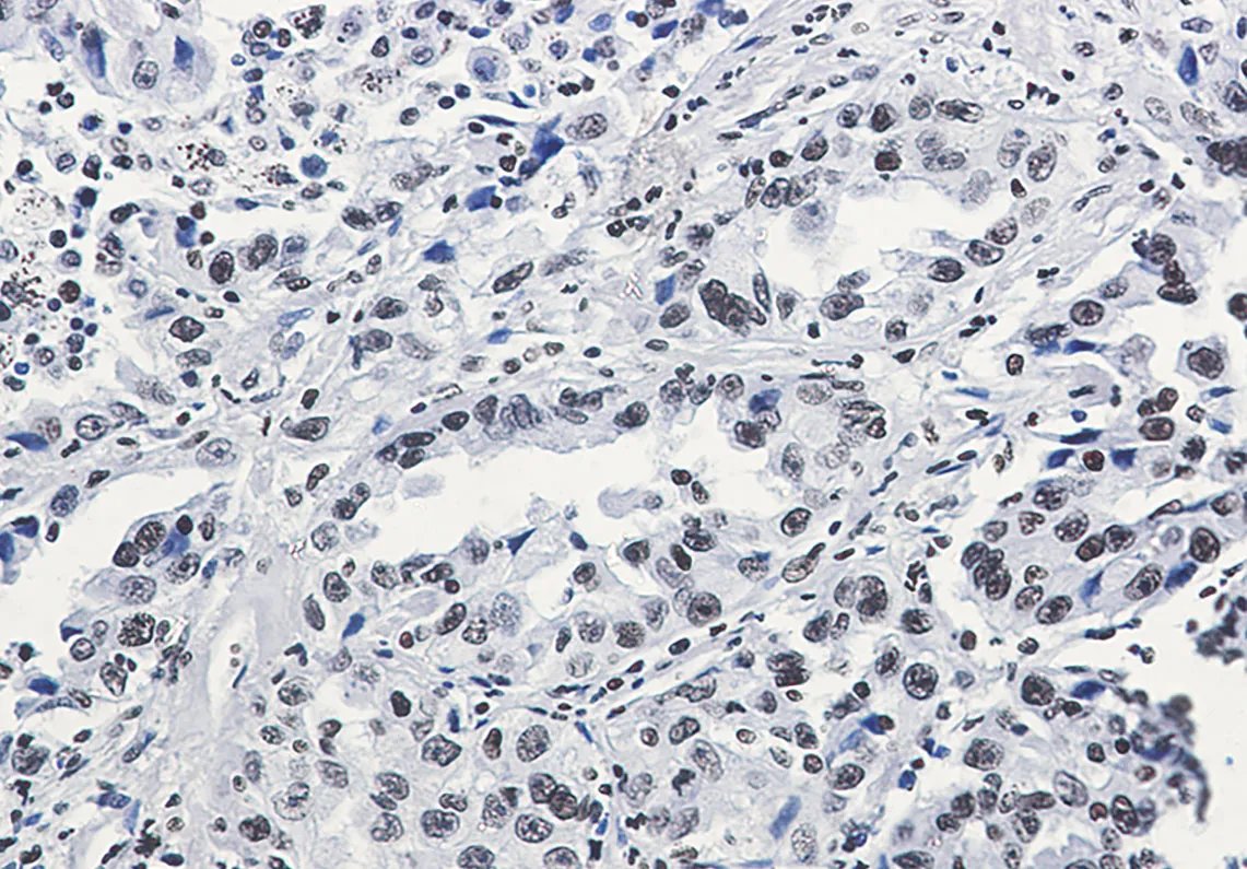 JasonJ641598's tweet photo. 🟣 Acetyl-H3K27 Rabbit mAb
⚡️ #Epigenetics | Human-Specific | ChIP-Validated
15kDa | WB/IHC/IF/ChIP/IP
Dilutions: WB 1:500 | ChIP 1:20
Storage: ❄️-20°C (No freeze-thaw!)
Sizes: 50μL/100μL | IgG Unconj.

Tag: #LabHack | #ChIPSeq | #Biotech 
Gene: H3C1 (P68431) https://t.co/BxFpBA1zDH
