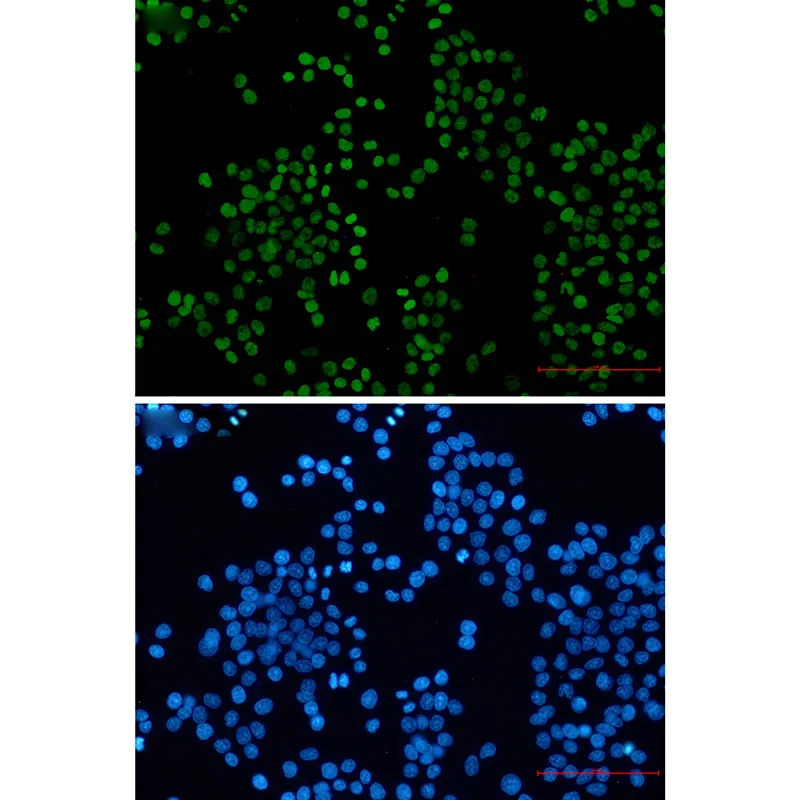 JasonJ641598's tweet photo. 🟣 Acetyl-H3K27 Rabbit mAb
⚡️ #Epigenetics | Human-Specific | ChIP-Validated
15kDa | WB/IHC/IF/ChIP/IP
Dilutions: WB 1:500 | ChIP 1:20
Storage: ❄️-20°C (No freeze-thaw!)
Sizes: 50μL/100μL | IgG Unconj.

Tag: #LabHack | #ChIPSeq | #Biotech 
Gene: H3C1 (P68431) https://t.co/BxFpBA1zDH