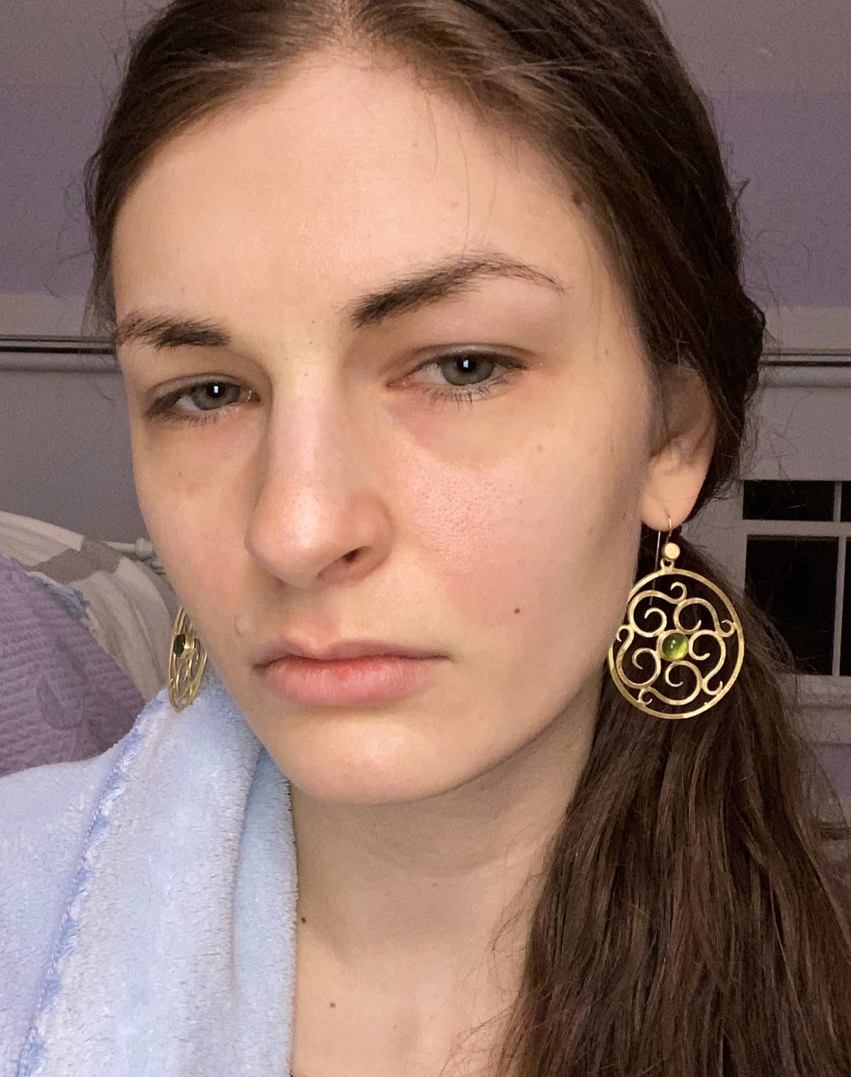 That MCAS flushing is real… just above my nasolabial fold …. Mostly my left cheek