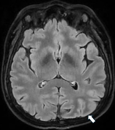 SPIN | Society of Pediatric Neuroimaging tweet media