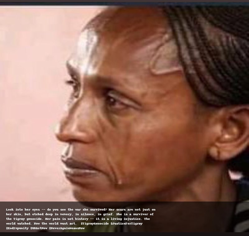 “I saw soldiers kill a taxi man and the two people in the taxi because there was a poster of the Tigrayan president in the car.” — Gidey, Humera resident.
What message does this send? That Black pain—African pain—is negotiable?
#TigrayGenocide  <a href="/achpr_cadhp/">African Commission on Human and Peoples' Rights</a>  HT <a href="/_Government_UK/">UKGovernment</a>