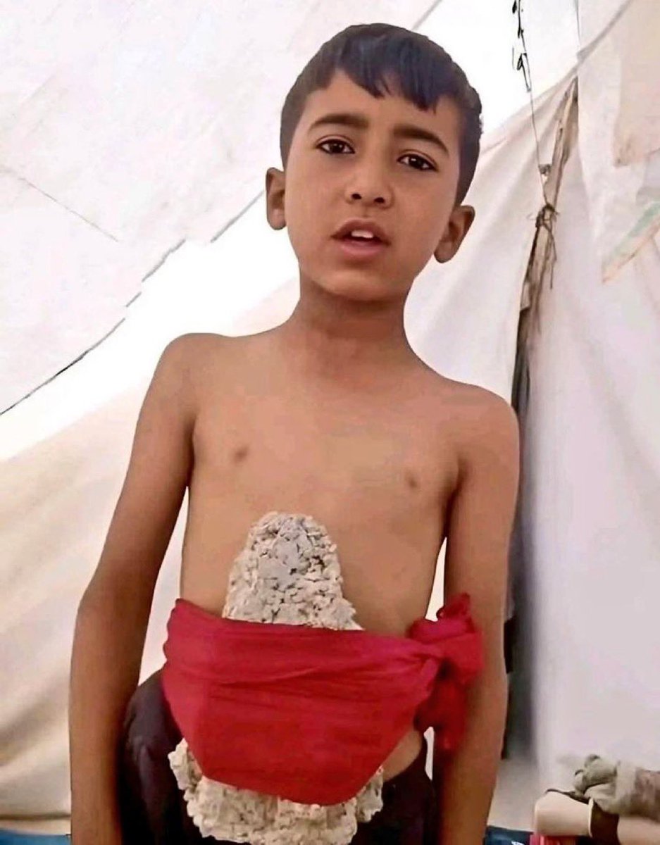 This child tied a rock around his stomach to stop himself from feeling the hunger 💔