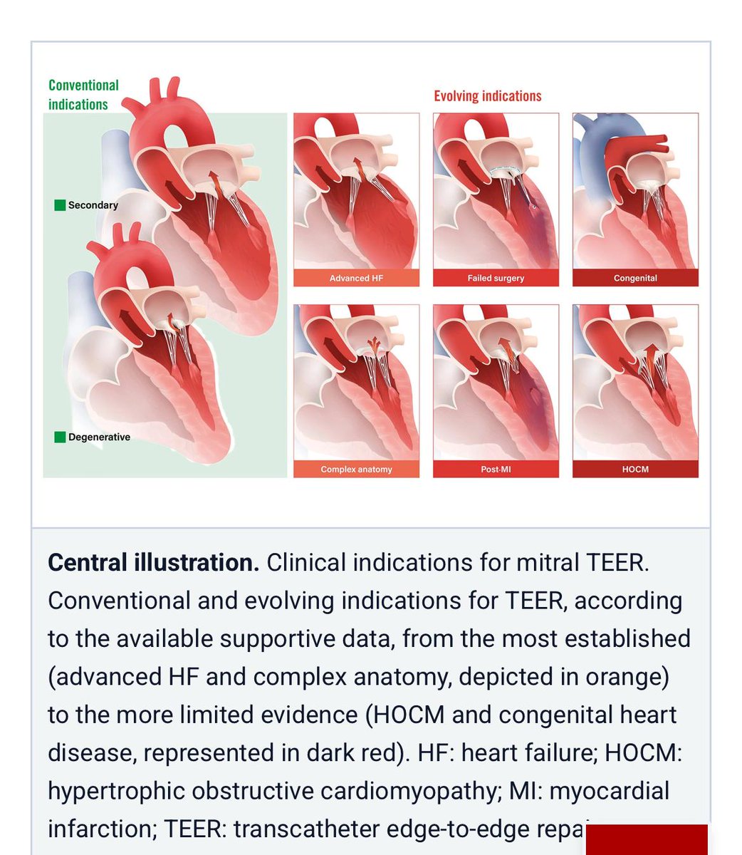 Elad Asher (@asherelad) on Twitter photo Kudos to Prof. <a href="/MShuvy/">Mony Shuvy</a> and Prof. <a href="/drmaisano/">francesco maisano</a> for their achievement <a href="/EuroInterventio/">EuroIntervention</a> best state of the art and illustration awards 🏆
<a href="/PCRonline/">PCRonline 🫀</a> @Sbrugaletta <a href="/Ortega_Paz/">Luis Ortega Paz</a> @Anazmicalik @guilbom <a href="/hect2701/">Prof. Hector M. Garcia-Garcia</a> <a href="/NicolaRyanI1/">Nicola Ryan</a> <a href="/DrPascalMeier/">Pascal Meier,MD</a> @W_jyg <a href="/ICigalini/">Ignacio Cigalini 🇦🇷</a> <a href="/Hragy/">Hany Ragy</a> <a href="/SABOURETCardio/">SABOURETCardiologist</a> Kudos to Prof. <a href="/MShuvy/">Mony Shuvy</a> and Prof. <a href="/drmaisano/">francesco maisano</a> for their achievement <a href="/EuroInterventio/">EuroIntervention</a> best state of the art and illustration awards 🏆
<a href="/PCRonline/">PCRonline 🫀</a> @Sbrugaletta <a href="/Ortega_Paz/">Luis Ortega Paz</a> @Anazmicalik @guilbom <a href="/hect2701/">Prof. Hector M. Garcia-Garcia</a> <a href="/NicolaRyanI1/">Nicola Ryan</a> <a href="/DrPascalMeier/">Pascal Meier,MD</a> @W_jyg <a href="/ICigalini/">Ignacio Cigalini 🇦🇷</a> <a href="/Hragy/">Hany Ragy</a> <a href="/SABOURETCardio/">SABOURETCardiologist</a>