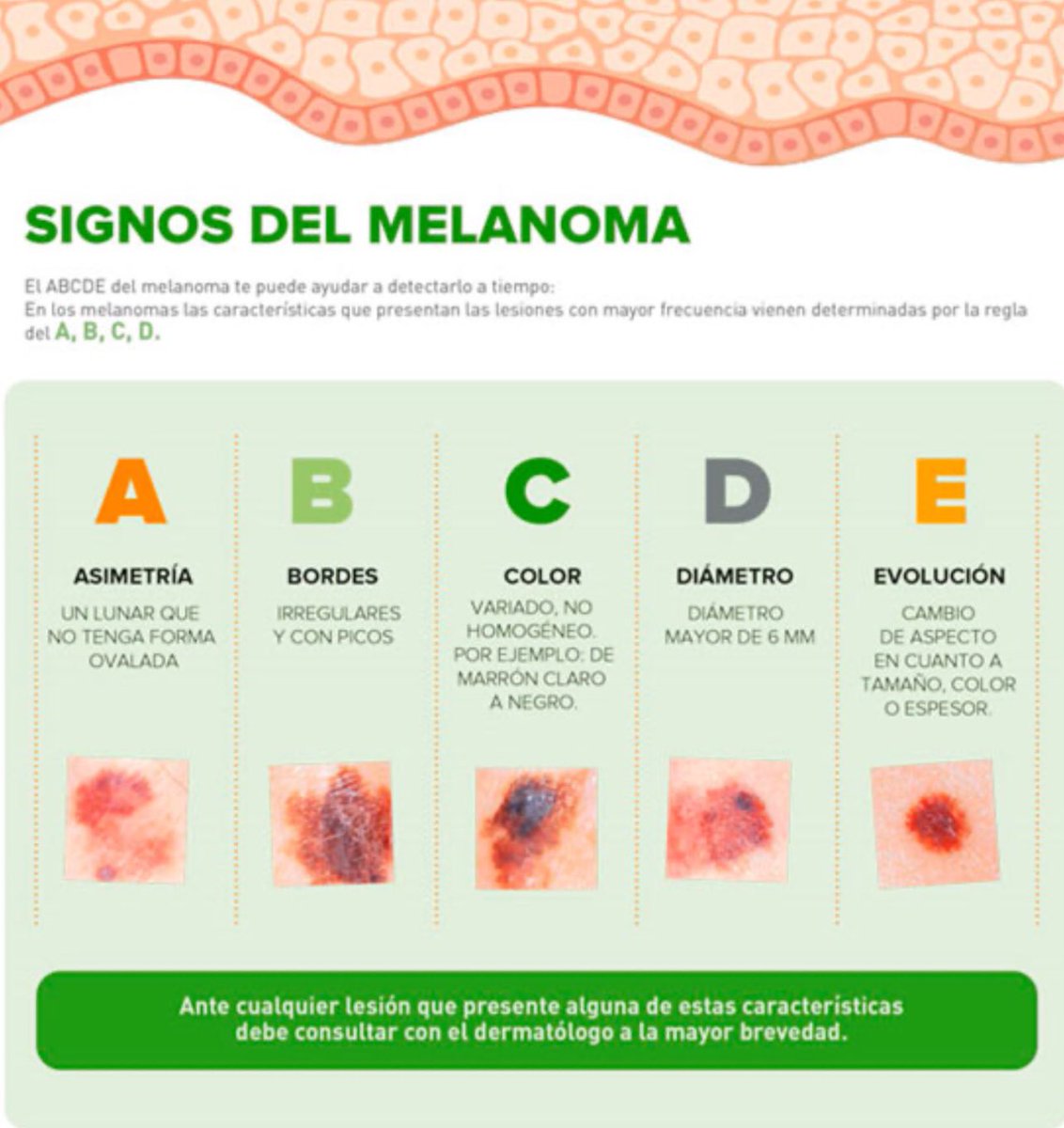 Es #DiaMundialDelMelanoma #WorldMelanomaDay
Revisad vuestros lunares. Detectar un #melanoma a tiempo salva vidas. La espalda es importante, revisadla con espejos, en pareja o en familia, es un acto de cuidado mutuo❤️😜👍
Completa info gr. a <a href="/_SEOM/">SEOM</a>👇
seom.org/info-sobre-el-…