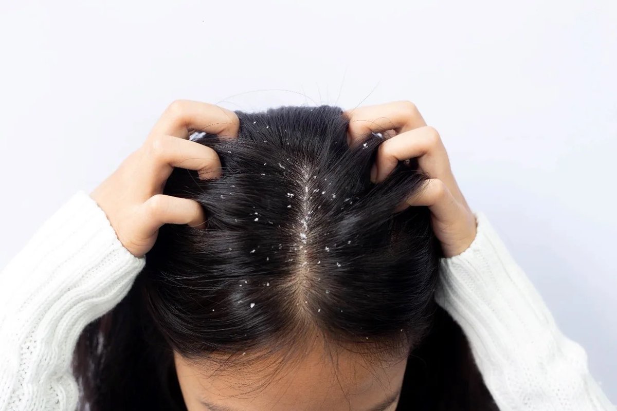 safonyameherbal's tweet photo. For DANDRUFF, Grind Xylopia (Erunje in yoruba, hwentia in twi), boil in water for 20mins wash your hair with the liquid extract twice daily 🍀.. it’s also very effective for hair growth and anti-grey hair 🤝 https://t.co/5EVIVULADg