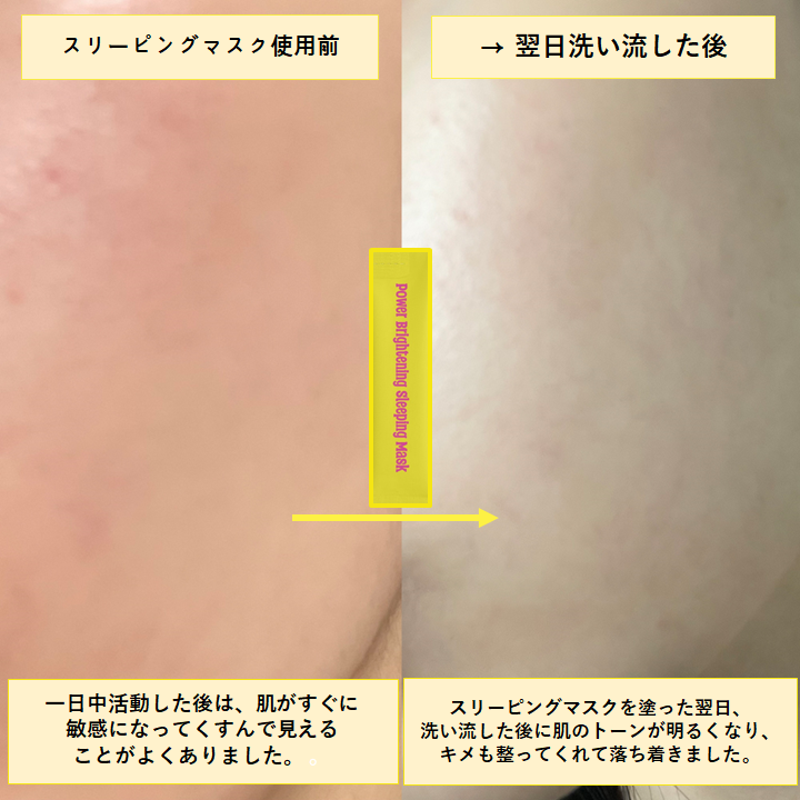 kosmetics_jp's tweet photo. 🌈【#Qoo10 #KOSMETICS #PUNCHLAB】🌈
#パンチラボ レアルなレビュー💝
✨パワーブライトニング スリーピングマスク✨
レモンより10倍高いビタミンCを
含まれている青みかんのビタミン🍊
寝ている間、簡単トーンアップ💡💡
試してみたくない❓
👇リンクはこちら👇
🔗https://t.co/e2jAIbgvkr https://t.co/NKbduCsSth