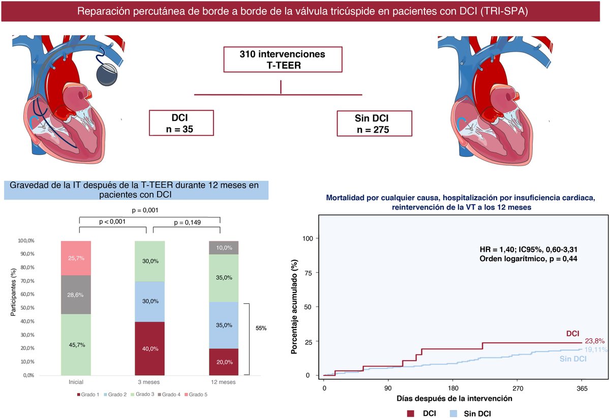 REC Publications (@revespcardiol) on Twitter photo Eficacia de la reparación percutánea de borde a borde para la insuficiencia tricuspídea en pacientes portadores de dispositivos cardiacos implantables: resultados del registro TRI-SPA #REC #Aheadofprint <a href="/a_rubi_5/">Andrea Ruberti</a> <a href="/pedro_cepas/">Pedro Cepas</a> <a href="/jcecharte/">Julio Echarte</a> <a href="/StructuralBCN/">Dabit Arzamendi</a> <a href="/VMonivas/">Vanessa Moñivas</a> <a href="/MPAOSS/">Manuel Pan</a> Eficacia de la reparación percutánea de borde a borde para la insuficiencia tricuspídea en pacientes portadores de dispositivos cardiacos implantables: resultados del registro TRI-SPA #REC #Aheadofprint <a href="/a_rubi_5/">Andrea Ruberti</a> <a href="/pedro_cepas/">Pedro Cepas</a> <a href="/jcecharte/">Julio Echarte</a> <a href="/StructuralBCN/">Dabit Arzamendi</a> <a href="/VMonivas/">Vanessa Moñivas</a> <a href="/MPAOSS/">Manuel Pan</a>