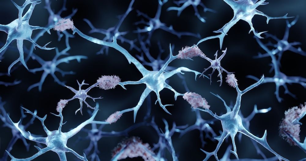 UK Dementia Research Institute (@ukdri) on Twitter photo New research led by Dr Frances Wiseman (UK DRI at <a href="/UCLIoN/">UCL Queen Square Institute of Neurology</a>) demonstrates that levels of Apolipoprotein E (APOE), a protein implicated in Alzheimer’s, are increased in the brains of individuals with Down syndrome & Alzheimer's 🧠
Read the full story👉buff.ly/5WnCY4s New research led by Dr Frances Wiseman (UK DRI at <a href="/UCLIoN/">UCL Queen Square Institute of Neurology</a>) demonstrates that levels of Apolipoprotein E (APOE), a protein implicated in Alzheimer’s, are increased in the brains of individuals with Down syndrome & Alzheimer's 🧠
Read the full story👉buff.ly/5WnCY4s