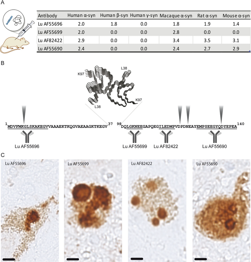The Science of Parkinson's (@scienceofpd) on Twitter photo Researchers from <a href="/LundbeckUS/">LundbeckUS</a> & collaborators present the rational selection of the monoclonal α-synuclein antibody amlenetug (Lu AF82422) for the treatment of α-synucleinopathies (#Parkinsons)
nature.com/articles/s4153… Researchers from <a href="/LundbeckUS/">LundbeckUS</a> & collaborators present the rational selection of the monoclonal α-synuclein antibody amlenetug (Lu AF82422) for the treatment of α-synucleinopathies (#Parkinsons)
nature.com/articles/s4153…