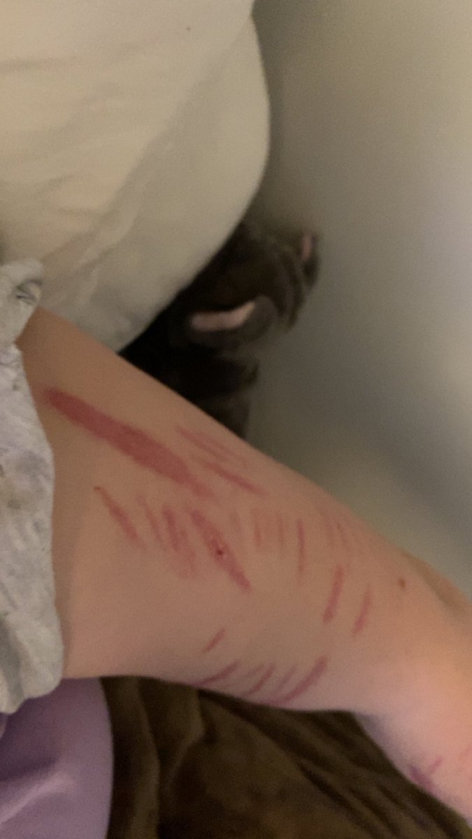 ViolaDinklez's tweet photo. left arm scars https://t.co/ZwsODSNnGX