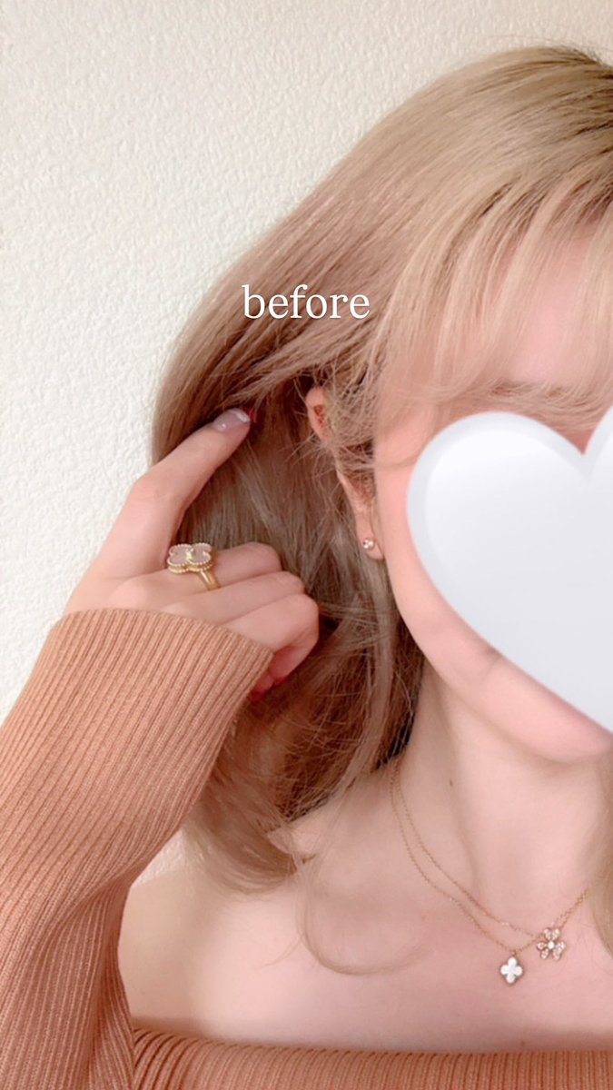 fuminyan1's tweet photo. たち耳ヒアルを韓国のクリニックでやってきたまとめ👂

#立ち耳ヒアル #イメージアップ整形外科
#たち耳フィラー #ヒアルロン酸
#イメージアップ皮膚科 https://t.co/ZSaQBa1PCo