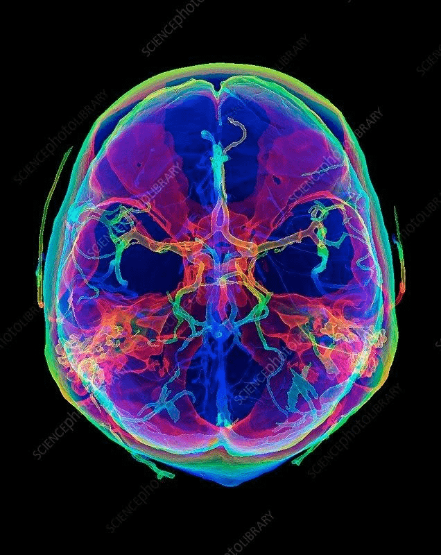 DrBobBeare's tweet photo. Childhood trauma reshapes your brain, disrupts your biology, and speeds up aging from the inside out.

Here’s how to uncover the hidden root—and start reversing it today (by a PhD psychologist): 🧵 https://t.co/XxKqRvQGD2