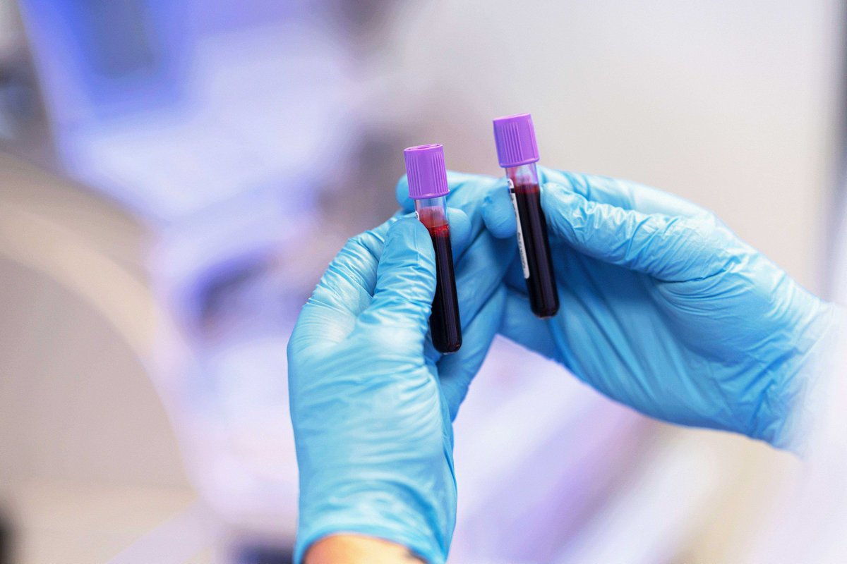El nostre Servei d'Hematologia ofereix diagnòstic i tractament per a malalties hematològiques i trastorns de la coagulació. Confia en el nostre equip d'experts! hscor.com/ca/cartera-de-…