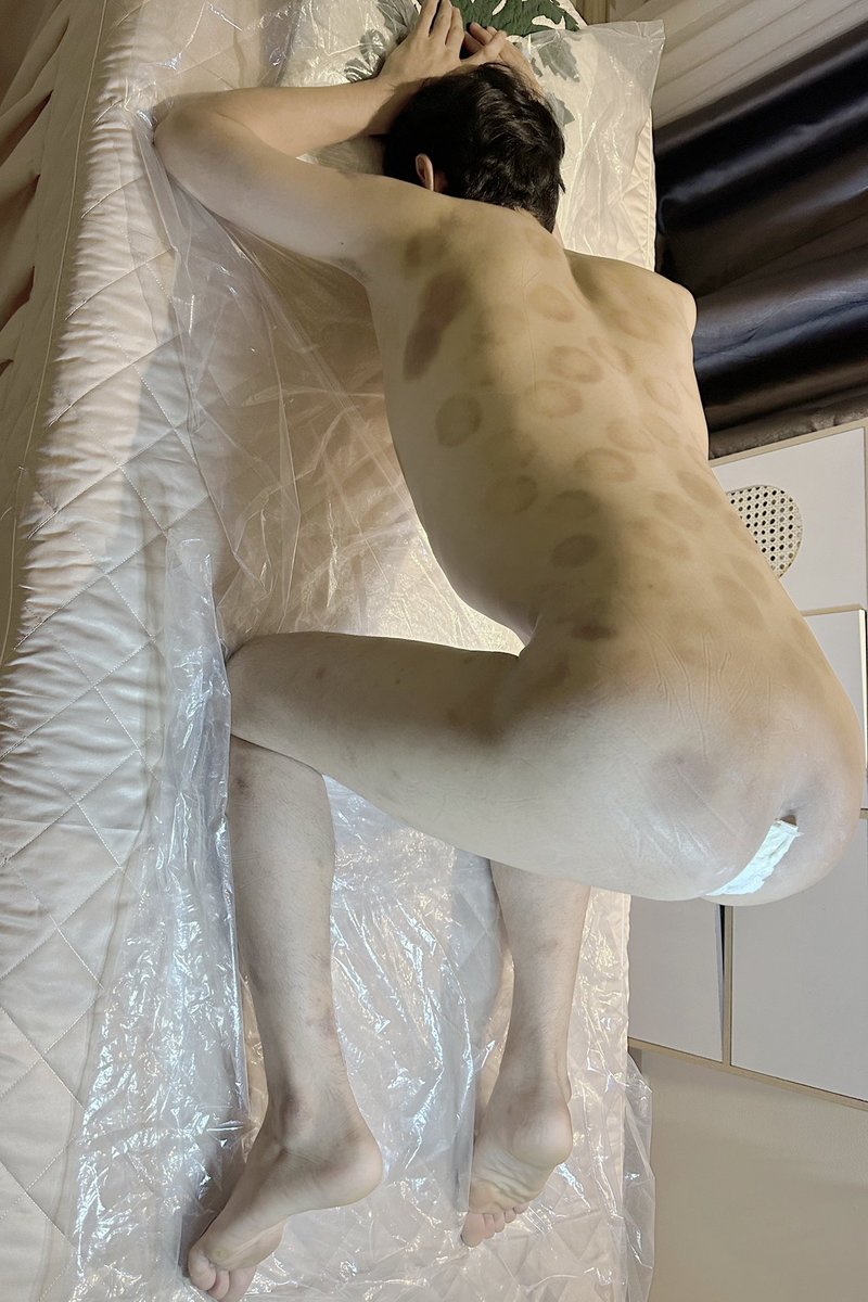 Trọn bộ Wax Bikini &amp; Ass cho bạn Khách Cần Thơ đến .