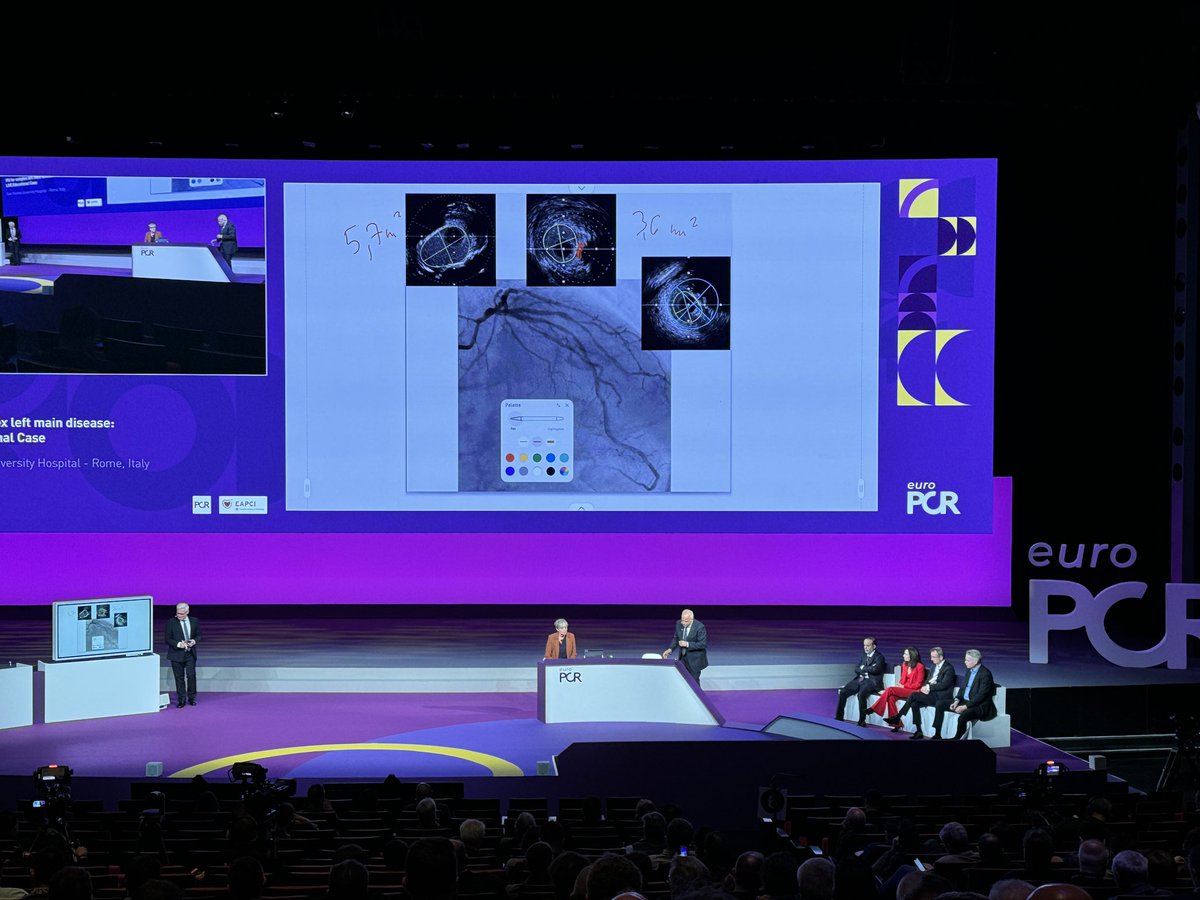 iheartfunction's tweet photo. This week several members of #ImprovingHeartFunction 🫀attended #EuroPCR 2025! @AlexMebazaa @EmanueleBarba13 @EGallinoro @belmontemarta1 @MCasenghi 
Learning to advance #heartfailuremanagement and #patientcare https://t.co/iJpg1pOveT