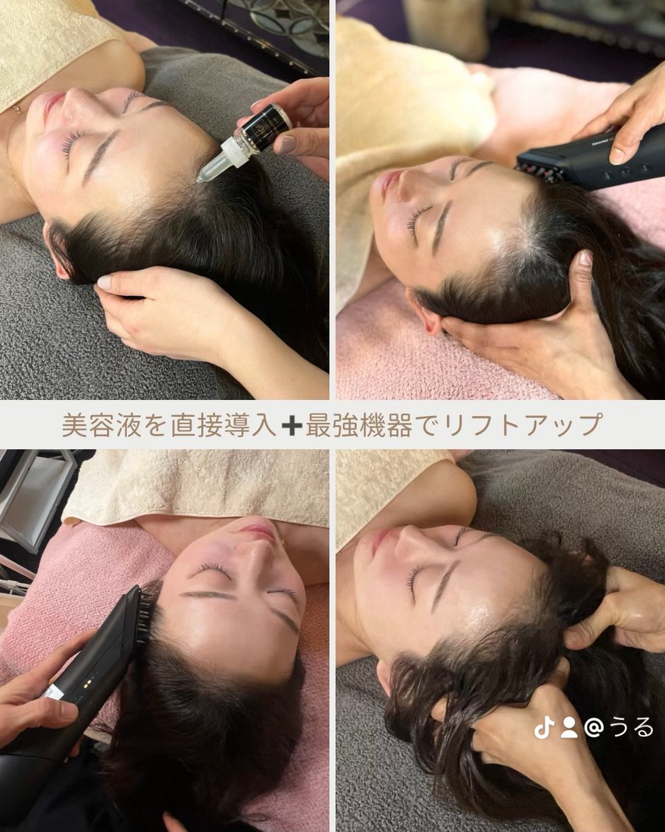 sengansensei's tweet photo. 小顔も髪も”土台”から変える
実は、顔と頭皮は1枚の皮。
だから頭皮がかたくなると...
顔がたるむ
髪にハリ・コシがなくなる
■ 目元がぼやけて見える
そして頭皮が1ミリたるむとお顔は1cmたるむ
お尻は5cmたるむとゆう恐ろしい事実をご存知でしょうか
頭皮がたった
1mmたるむだけで...
肌は10倍... https://t.co/Gepu0m1JDs