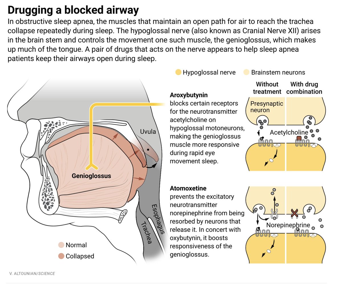 Eric Topol (@erictopol) on Twitter photo A pill for sleep apnea that keeps the airway open <a href="/ScienceMagazine/">Science Magazine</a> <a href="/meredithwadman/">Meredith Wadman</a>
science.org/content/articl… A pill for sleep apnea that keeps the airway open <a href="/ScienceMagazine/">Science Magazine</a> <a href="/meredithwadman/">Meredith Wadman</a>
science.org/content/articl…
