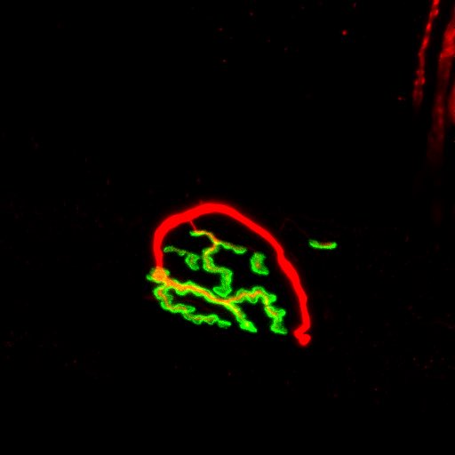 Michael J. Kamal (@michaeljkamal) on Twitter photo It’s #MicroscopyFriday so enjoy some beautiful NMJs taken by the Ljubicic lab here <a href="/McMasterU/">McMaster University</a> <a href="/MYOTWlTTER/">#myotwítter</a> It’s #MicroscopyFriday so enjoy some beautiful NMJs taken by the Ljubicic lab here <a href="/McMasterU/">McMaster University</a> <a href="/MYOTWlTTER/">#myotwítter</a>