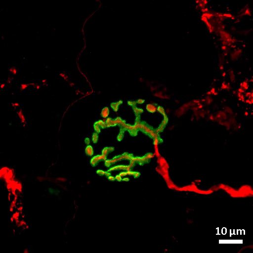 michaeljkamal's tweet image. It’s #MicroscopyFriday so enjoy some beautiful NMJs taken by the Ljubicic lab here @McMasterU @MYOTWlTTER