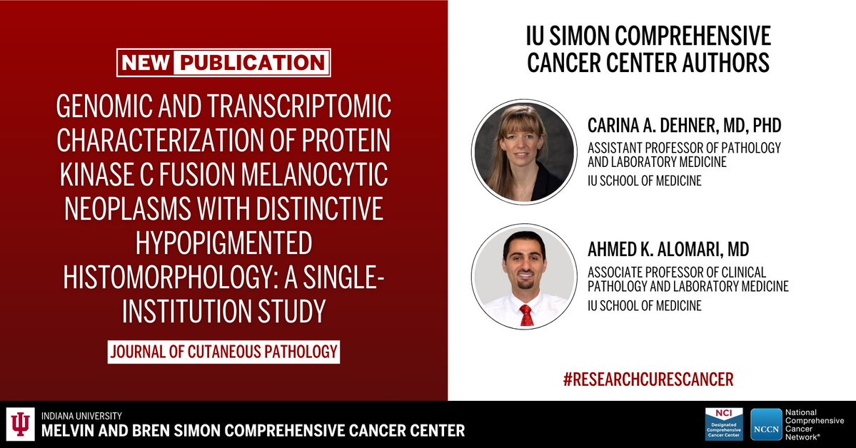 IU Simon Comprehensive Cancer Center (@iucancercenter) on Twitter photo The cancer center’s Carina A. Dehner, MD, PhD, Ahmed K. Alomari, MD, and colleagues contributed to an article published in the Journal of Cutaneous Pathology. Learn more: ow.ly/kBMq50Vyzc1. #ResearchCuresCancer #NCIcomprehensive <a href="/JCutaneousPath/">J Cutan Pathol</a> The cancer center’s Carina A. Dehner, MD, PhD, Ahmed K. Alomari, MD, and colleagues contributed to an article published in the Journal of Cutaneous Pathology. Learn more: ow.ly/kBMq50Vyzc1. #ResearchCuresCancer #NCIcomprehensive <a href="/JCutaneousPath/">J Cutan Pathol</a>
