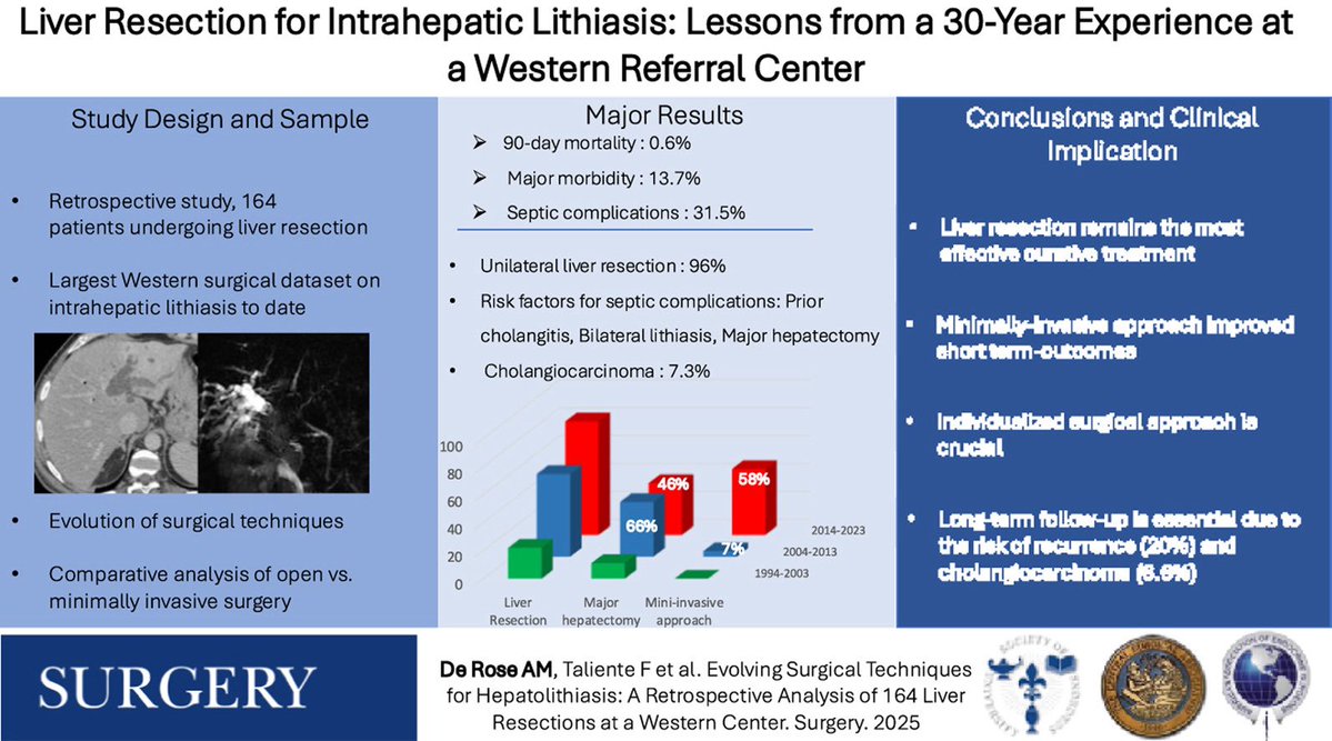 Steven D Wexner MD, PhD (@swexner) on Twitter photo Evolving surgical techniques for hepatolithiasis: A retrospective anal... sciencedirect.com/science/articl… excellent <a href="/talientef/">Francesco Taliente</a> study in <a href="/SurgJournal/">SURGERY Journal</a> Evolving surgical techniques for hepatolithiasis: A retrospective anal... sciencedirect.com/science/articl… excellent <a href="/talientef/">Francesco Taliente</a> study in <a href="/SurgJournal/">SURGERY Journal</a>