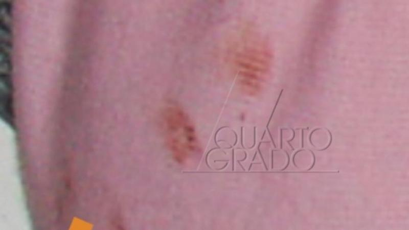 DavePollak4's tweet photo. se vi interessa sapere perché parlo di MAFIA nel caso di #GarlasKKo #Garlasco leggete qua sotto.
a 4 gg dal delitto si era VICINISSIMI alla verità.
se "qualcuno" non fosse riuscito a far cancellare le IMPRONTE DIGITALI di "un suo stretto parente" sulla spalla sinistra di Chiara (chi ha girato il corpo nel suo stesso sangue ha cancellato 4 impronte EVIDENTISSIME di dita piccole, quasi certamente di donna), il caso si sarebbe risolto in pochi giorni.
da: La Provincia Pavese del 17 agosto 2007 (4gg dopo l'omicidio di #ChiaraPoggi
#GARLASCO. "Sono due le persone sospettate per l’omicidio di Chiara Poggi e la vittima conosceva bene entrambe.
Lunedì mattina l’assassino avrebbe telefonato alla 26enne laureata in economia per essere sicura che fosse sola a casa.
Dopo l’autopsia di ieri si pensa che l’omicida abbia colpito con un martello.
Si indaga anche su un’impronta nel sangue di Chiara lasciata da una scarpa da donna, un’impronta che i Ris di Parma hanno trovato nella casa di via Pascoli 8.
Il cerchio si sta quindi stringendo intorno al misterioso assassino, o all’assassina, come sembra più probabile. Non è da escludere che, in tempi brevi, vengano presi provvedimenti.
Ma andiamo con ordine.
Gli investigatori stanno esaminando centinaia di numeri telefonici anche per capire le amicizie dei due fidanzati, che stavano insieme da circa quattro anni.
Tra le telefonate ricevute da Chiara potrebbe esserci anche quella dell’assassino: alcuni numeri sono ritenuti particolarmente interessanti dai carabinieri, coordinati dal colonnello Giancarlo Sangiuliano.
La giornata di ieri è stata anche quella dell’autopsia eseguita a Vigevano dagli esperti dell’istituto di Medicina Legale dell’Università di Pavia.
Chiara Poggi è stata uccisa con due colpi inferti al viso (uno al sopracciglio destro, l’altro allo zigomo sinistro) e con altri fendenti, almeno tre, alla nuca.
Colpi vibrati con forza e con rabbia che hanno sfondato il cranio.
Per quanto riguarda l’arma del delitto, è ancora difficile avanzare un’ipotesi.
Si parla di un martello oppure di un altro oggetto di ferro o di acciaio.
I carabinieri hanno prelevato dall’abitazione di Chiara Poggi un alare da camino e un portavaso in ottone alto un metro, oggetti che l’assassino avrebbe potuto usare come arma e poi lasciare sul posto.
L’autopsia di ieri però fa pensare che l’omicida avesse con sé l’arma del delitto e se ne sia sbarazzato successivamente.
L’azione dell’assassino è stata rapidissima.
Chiara Poggi non ha nemmeno avuto il tempo di difendersi: i fendenti sono stati vibrati in rapida successione.
L’omicida avrebbe anche cercato di trascinare via il corpo (forse per nasconderlo), ma non ci è riuscito.
E ha lasciato la villa di via Pascoli forse in sella all’introvabile bicicletta nera. Le indagini, ieri, hanno avuto un impulso improvviso. L’impronta della scarpa da donna trovata all’interno della villa è stato forse l’elemento che potrebbe segnare una svolta. Ieri sera i carabinieri hanno chiuso il cavo di via Lucchina alla ricerca dell’arma del delitto. Perchè proprio quel canale che si trova a qualche centinaio di metri da via Pascoli? Per il momento è difficile dare una spiegazione, ma sembra che il cerchio si stia stringendo intorno all’assassino. Ed i sospetti su una donna sono più che fondati. Non è da escludere che qualcuno abbia visto qualcosa di interessante e si sia presentato in caserma. Una testimonianza che potrebbe risultare decisiva per risolvere il giallo di via Pascoli. In ogni caso le indagini si sono improvvisamente indirizzate verso una persona precisa, sembra molto vicina a Chiara Poggi.
I carabinieri hanno anche proseguito gli interrogatori nella speranza di raccogliere altri indizi. In ogni caso la pista dell’omicidio dettato dalla gelosia sembra la più probabile. Chi ha ucciso Chiara Poggi la odiava tanto profondamente da eliminarla.
Una parte ancora irrisolta del giallo riguarda la misteriosa bicicletta nera da donna, che una vicina ha visto appoggiata al muro della villa del delitto, alle 9.10 di lunedì mattina.
Un’ora dopo non c’era più. Una bicicletta scomparsa nel nulla. I carabinieri l’hanno cercata per tutto il paese, ma senza fortuna. La testimonianza della vicina di casa è giudicata molto attendibile. La pista sembra importante, perchè l’ora della morte è indicata tra le 9.30 e le 11".
SI SAPEVA GIA' TUTTO.
io vorrei vedere in GALERA tutti i responsabili, i corrotti e i corruttori in primo luogo, di questa vicenda.
senza riguardo se siano all'interno di FF.OO. Magistratura inquirente e anche GIUDICANTE, parenti anche strettissimi, amici e conoscenti.
