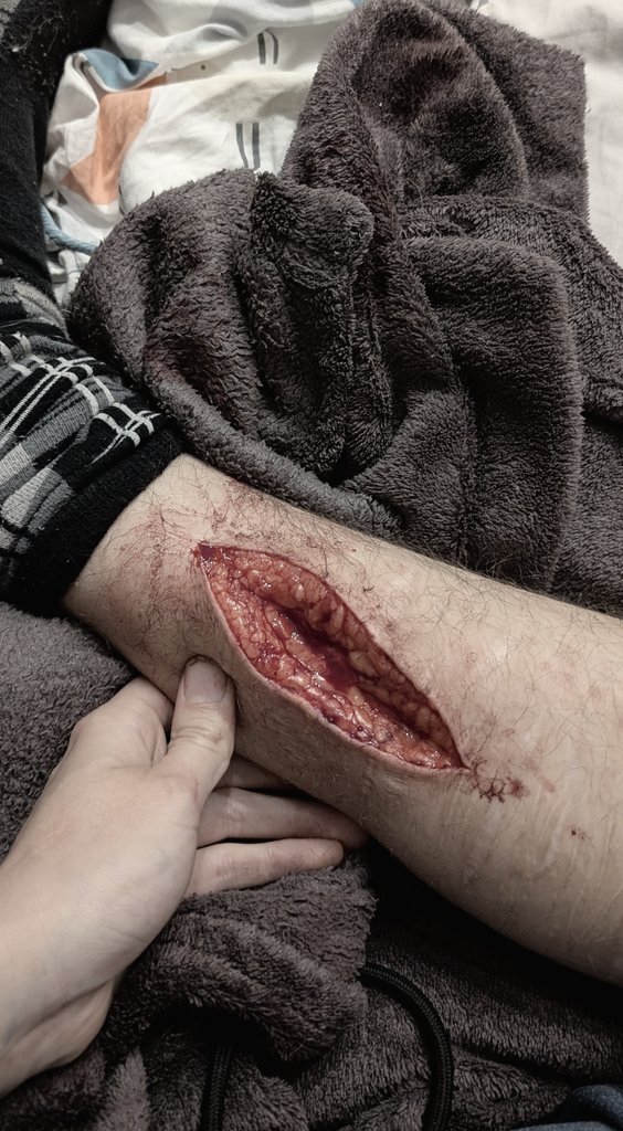 muUted_'s tweet photo. R3l4pse on calf 5 days ago zhehhehdhdhd
Take care &amp; don't compare https://t.co/t27VlSAl5w