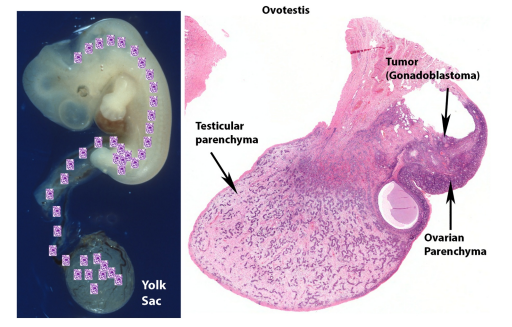 mreyesm's tweet image. Happy to share our new contribution to the #Pasthology #PediPath of #DisordersOfSexDevelopment published today in CA: A Cancer Journal for Clinicians (IF: 512) 😅We hope you find it useful! #Uropath @UMiamiPathology pubmed.ncbi.nlm.nih.gov/40406981/
