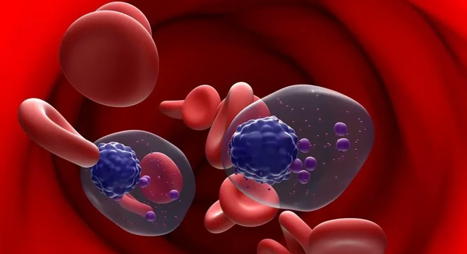OncoDaily (@oncodaily) on Twitter photo Genomic Landscape of Multiple Myeloma and Its Precursor Conditions - Jean-Baptiste Alberge (<a href="/JbAlberge/">JB Alberge</a>)
<a href="/NatureGenet/">Nature Genetics</a> <a href="/CancerWorldmag/">CancerWorld</a>
oncodaily.com/blog/jean-bapt…
#OncoDaily #Oncology #Cancer #Health #Medicine #MedTwitter #MedEd #MedOnc #MedNews #MulripleMyeloma Genomic Landscape of Multiple Myeloma and Its Precursor Conditions - Jean-Baptiste Alberge (<a href="/JbAlberge/">JB Alberge</a>)
<a href="/NatureGenet/">Nature Genetics</a> <a href="/CancerWorldmag/">CancerWorld</a>
oncodaily.com/blog/jean-bapt…
#OncoDaily #Oncology #Cancer #Health #Medicine #MedTwitter #MedEd #MedOnc #MedNews #MulripleMyeloma