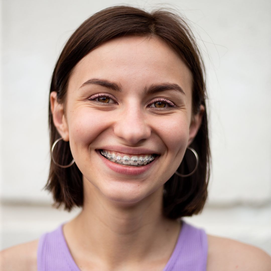 premiersmilectr's tweet photo. Unlike traditional braces, FastBraces use a unique technology that moves both the crown and root of your teeth simultaneously, shortening your treatment time significantly.

💻https://t.co/D1Xs2uqPjh
#PremierSmileCenter #FastBraces https://t.co/M0TlfPL1UJ