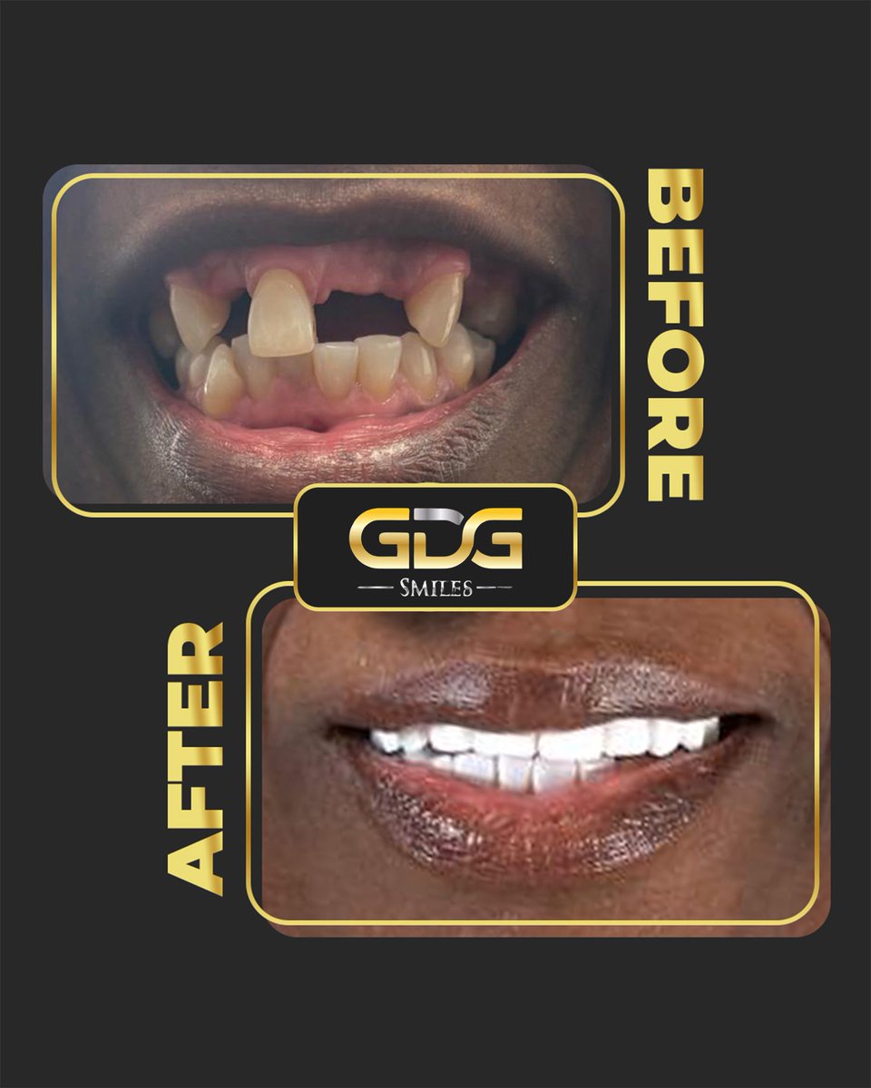 GDG Smiles tweet media