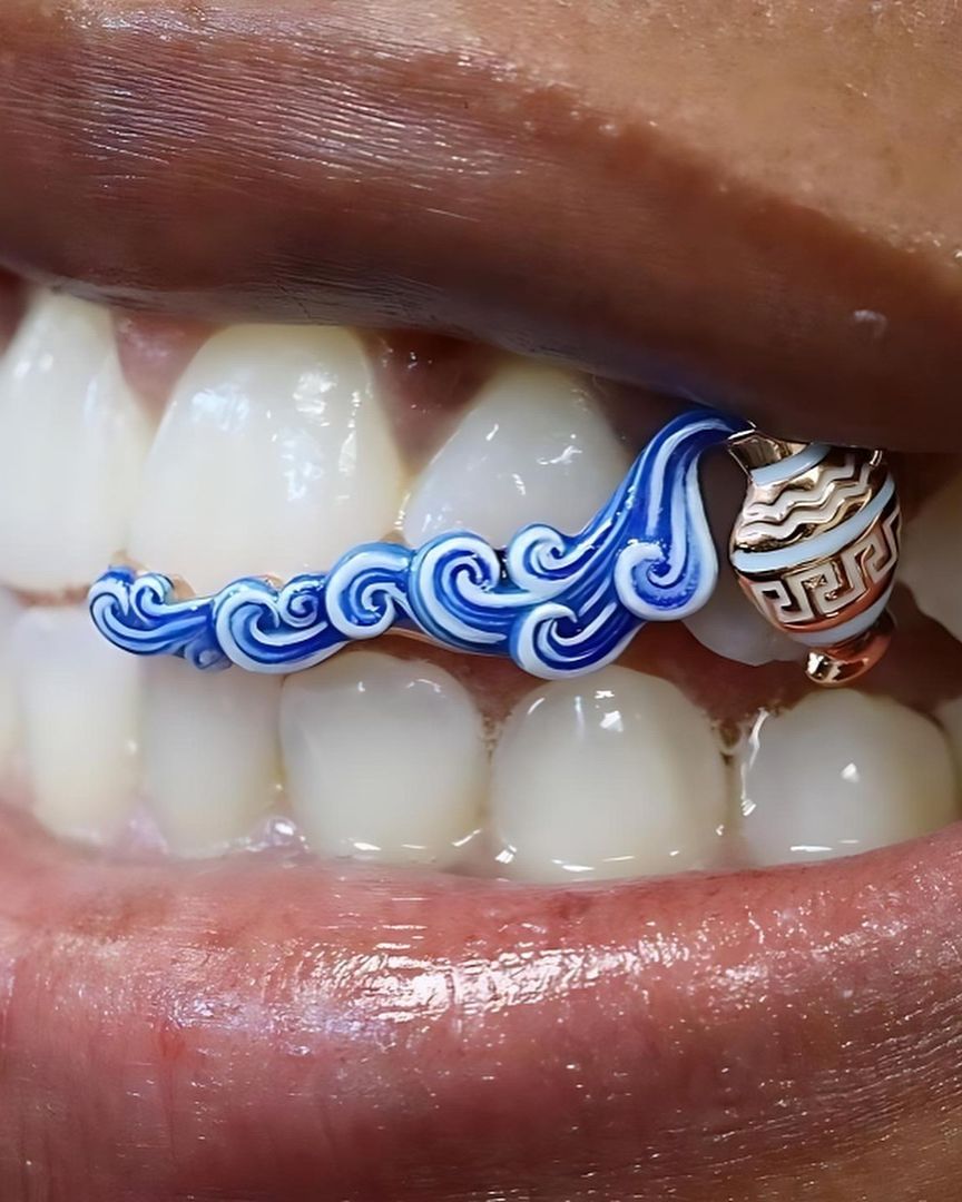 rogue's tweet photo. The art of grillz https://t.co/j5MDFhNUGF
