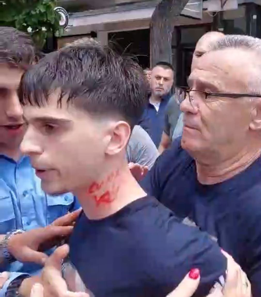 Da je ovo uradio nas policajac recimo u Presevu, izaslo bi na ulicu 30.000 siptara da protestvuje. Kod nas je jedva vest provucena. Postali smo pizde od nacije i tu nema niceg dobrog za buducnost.
