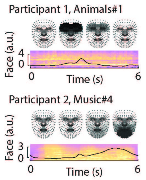 ScienceMagazine's tweet image. A new @ScienceTM study of patients with #tinnitus shows pupil dilations and shifts in facial expressions can predict symptom severity, pointing to a more objective scoring alternative to self-report questionnaires for tinnitus research. scim.ag/3GXiRdn