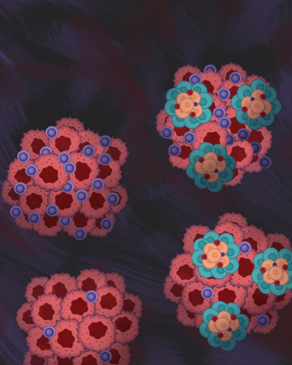 Cancer Discovery (@cd_aacr) on Twitter photo From the May issue: 'Presence of Tertiary Lymphoid Structures and Exhausted Tissue-Resident T Cells Determines Clinical Response to PD-1 Blockade in RCC brnw.ch/21wSSDz
By Miya Hugaboom, <a href="/lena__wirth/">Lena Wirth</a>, Kelly Street, <a href="/nruthen16/">Neil Ruthen</a>, Michael Atkins, Catherine Wu, <a href="/BraunMDPhD/">David Braun</a> From the May issue: 'Presence of Tertiary Lymphoid Structures and Exhausted Tissue-Resident T Cells Determines Clinical Response to PD-1 Blockade in RCC brnw.ch/21wSSDz
By Miya Hugaboom, <a href="/lena__wirth/">Lena Wirth</a>, Kelly Street, <a href="/nruthen16/">Neil Ruthen</a>, Michael Atkins, Catherine Wu, <a href="/BraunMDPhD/">David Braun</a>
