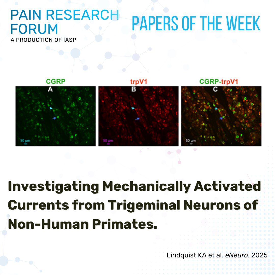 IASP (@iasppain) on Twitter photo Read this #PapersoftheWeek #EditorsPick from <a href="/KarenALindquist/">Karen Ann Lindquist</a> et al. and <a href="/SfNJournals/">SfN Journals</a>’s #eNeuro investigating mechanically activated currents from trigeminal neurons of non-human primates bit.ly/3GOnmXk #PRF Read this #PapersoftheWeek #EditorsPick from <a href="/KarenALindquist/">Karen Ann Lindquist</a> et al. and <a href="/SfNJournals/">SfN Journals</a>’s #eNeuro investigating mechanically activated currents from trigeminal neurons of non-human primates bit.ly/3GOnmXk #PRF