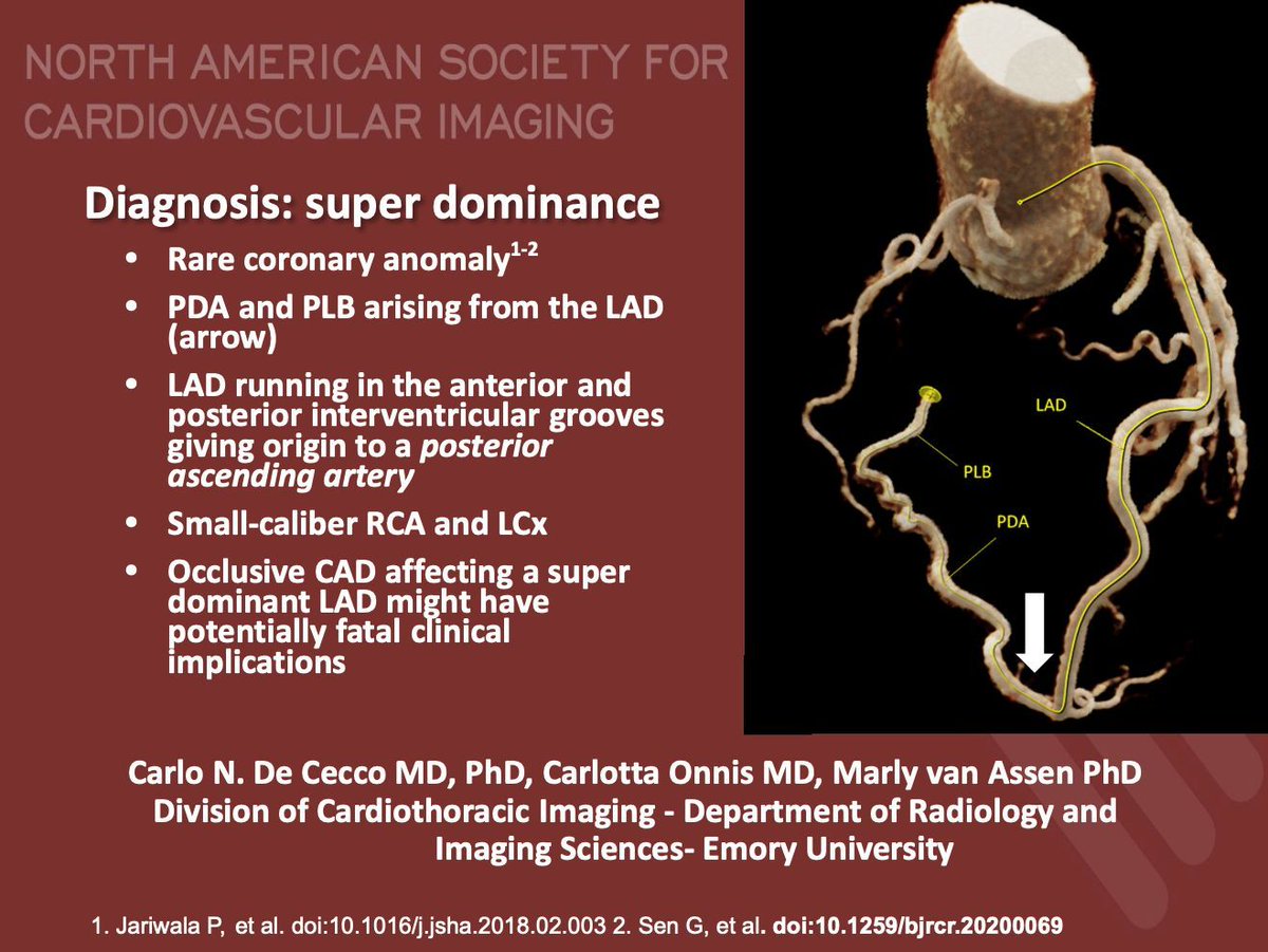 NASCI (@nascisociety) on Twitter photo #NASCI Case Series
Case 78 Diagnosis
Courtesy of <a href="/DeCeccoCN/">Carlo N. De Cecco, MD, PhD</a> <a href="/CarlottaOnnis/">Carlotta Onnis</a> <a href="/marly_van_assen/">Marly van Assen</a> from <a href="/Heart_AI_Lab/">Emory Cardiothoracic Imaging & AI Lab</a> <a href="/EmoryRadiology/">Emory Radiology</a>
#whyCMR #YesCCT
<a href="/GregKicska/">Gregory Kicska</a> <a href="/JRevRad1/">Jonathan Revels DO, FSAR</a> <a href="/dianalitmano/">diana litmanovich</a> <a href="/DanielVargasMD/">Daniel Vargas, MD</a> <a href="/kirschj/">Jacobo Kirsch, MD, MBA, FACR</a> <a href="/prachipagarwal/">Prachi Agarwal</a> <a href="/AwsHamid5/">Aws Hamid, MD, MS</a> <a href="/EscrOffice/">ESCR Vienna</a> <a href="/CarlottaOnnis/">Carlotta Onnis</a> <a href="/DeCeccoCN/">Carlo N. De Cecco, MD, PhD</a> #NASCI Case Series
Case 78 Diagnosis
Courtesy of <a href="/DeCeccoCN/">Carlo N. De Cecco, MD, PhD</a> <a href="/CarlottaOnnis/">Carlotta Onnis</a> <a href="/marly_van_assen/">Marly van Assen</a> from <a href="/Heart_AI_Lab/">Emory Cardiothoracic Imaging & AI Lab</a> <a href="/EmoryRadiology/">Emory Radiology</a>
#whyCMR #YesCCT
<a href="/GregKicska/">Gregory Kicska</a> <a href="/JRevRad1/">Jonathan Revels DO, FSAR</a> <a href="/dianalitmano/">diana litmanovich</a> <a href="/DanielVargasMD/">Daniel Vargas, MD</a> <a href="/kirschj/">Jacobo Kirsch, MD, MBA, FACR</a> <a href="/prachipagarwal/">Prachi Agarwal</a> <a href="/AwsHamid5/">Aws Hamid, MD, MS</a> <a href="/EscrOffice/">ESCR Vienna</a> <a href="/CarlottaOnnis/">Carlotta Onnis</a> <a href="/DeCeccoCN/">Carlo N. De Cecco, MD, PhD</a>