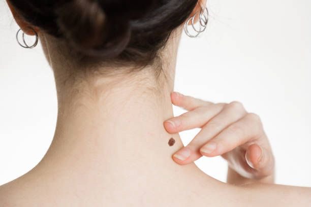 قصيدي كتبته من مشاعر سجينة بال
وجاب الله اللي عجّلت وقت تفريجي

رمتني بسهم عيونها الساطي القتّال
وقامت تقرّبني على الموت تدريجي

أبرخص لها روحي والاحساس والاموال
والى من رضت بي قلت في يوم تتويجي

ترى اللي ينافسني على العنق حبّة خال
لعينة وتقعد في مكان استراتيجي 😅

ع. خ.
#شعر