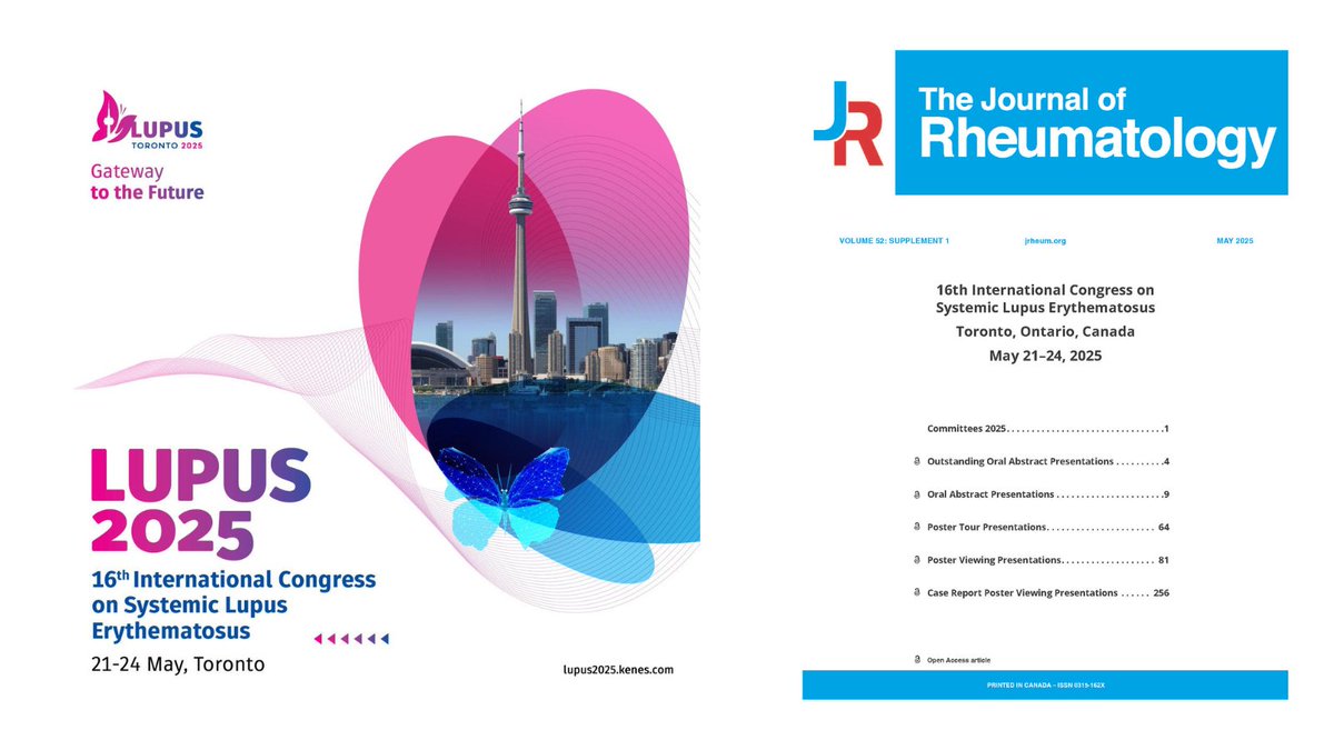 jrheum's tweet image. 🙌 Day 3 at @LupusCongress.

Together, we can advance research, improve lives, and move closer to a cure for lupus.

@jrheum is proud to publish the official #LUPUS2025 abstracts.

Dive into this cutting-edge research: 🔗jrheum.org/content/52/Sup…

#lupus #lupusresearch