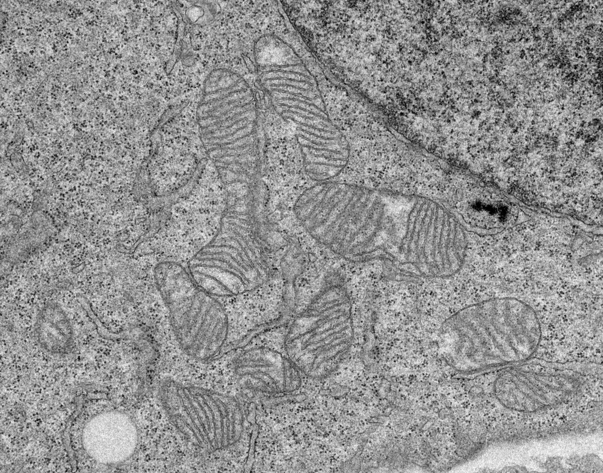 CSIC (@csic) on Twitter photo 🦠 Descubren el papel clave de un gen en la producción de energía de nuestras células
🔬Este avance del <a href="/CBM_CSIC_UAM/">Centro de Biología Molecular Severo Ochoa</a> podría ayudar a diagnosticar y tratar #EnfermedadesRaras que afectan a miles de personas y que no tienen causa genética conocida
➡️tiny.cc/qwmk001 🦠 Descubren el papel clave de un gen en la producción de energía de nuestras células
🔬Este avance del <a href="/CBM_CSIC_UAM/">Centro de Biología Molecular Severo Ochoa</a> podría ayudar a diagnosticar y tratar #EnfermedadesRaras que afectan a miles de personas y que no tienen causa genética conocida
➡️tiny.cc/qwmk001