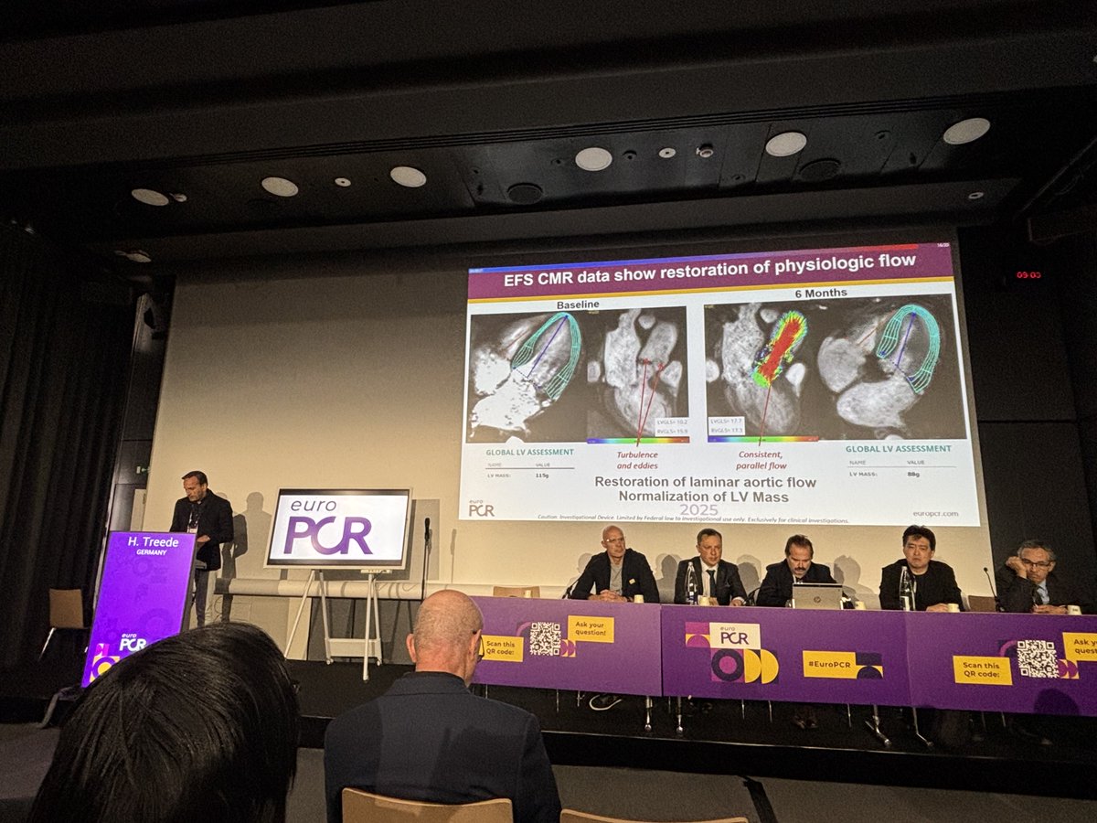 AnterisTech's tweet image. DurAVR® THV was featured in a presentation yesterday at #EuroPCR at the “Innovation to address unmet clinical needs in transcatheter therapies” session. Dr. Hendrik Treede presented present and future TAVI innovations, including DurAVR® THV, a new class of TAVR (biomimetic).…