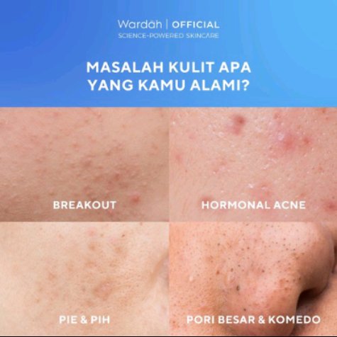 zeez3e's tweet photo. WARDAH UV Shield Acne Calming Sunscreen 🧴 

https://t.co/yoXdxkiWUm https://t.co/0izloGATho