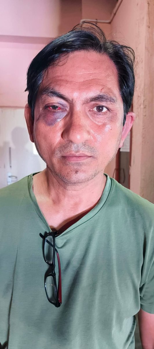 RakshakThe's tweet photo. पटेल हॉस्पिटल के बाउंसर्स द्वारा एक व्यक्ति के साथ की गई बर्बर मारपीट को लेकर पटेल नगर थाने में शिकायत दी गई,लेकिन अब तक कोई कार्रवाई नहीं हुई है। हम संबंधित अधिकारियों से निष्पक्ष जांच और त्वरित कार्रवाई की अपेक्षा करते हैं। @DelhiPolice @CPDelhi @LtGovDelhi #Justice #RuleOfLaw https://t.co/lJuQmmFof5