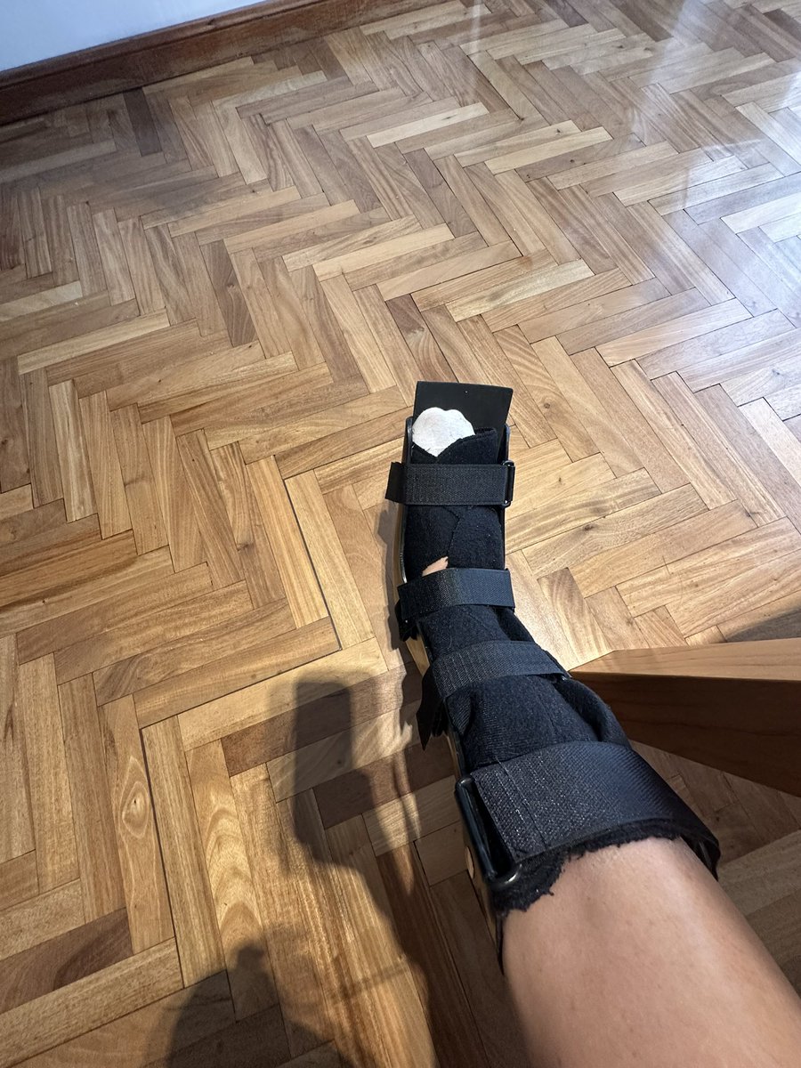 El domingo yendo a votar me doblé el pie y pummm fractura del 5to metatarsiano. Odiada es poco 😒